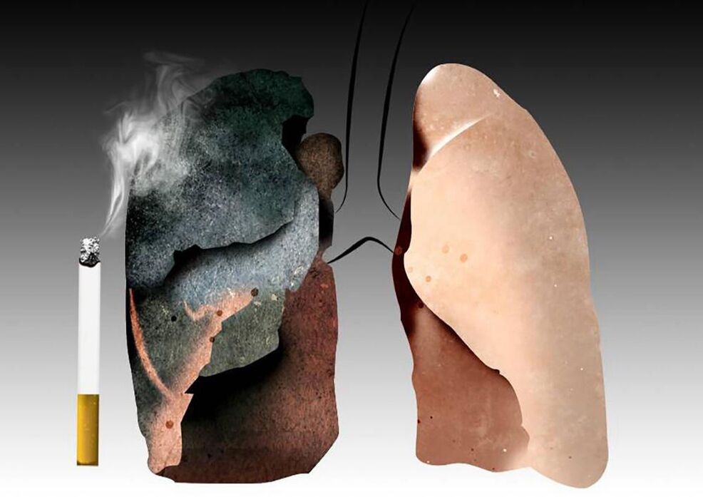 polmoni di un fumatore